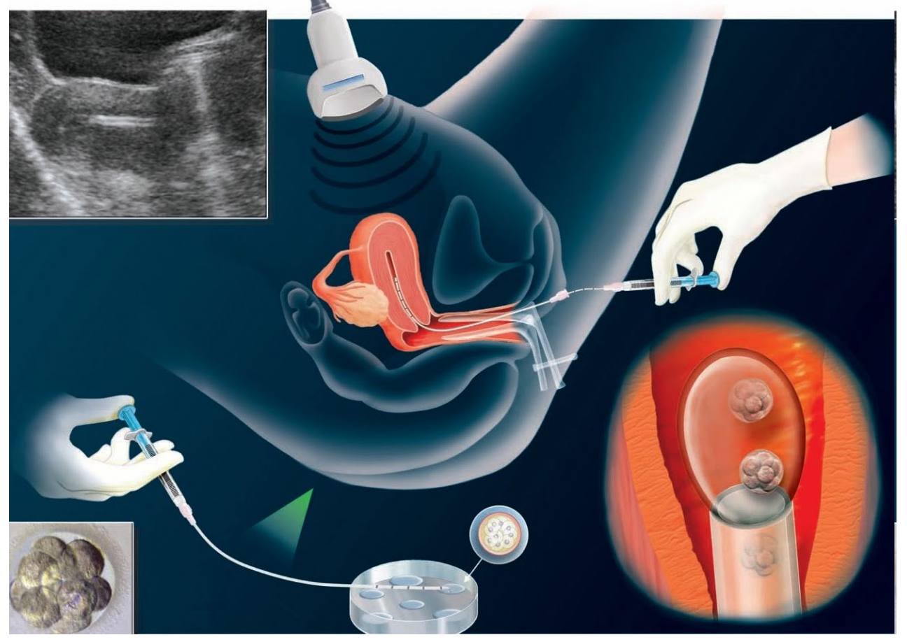 泰国LRC生殖中心(图32)