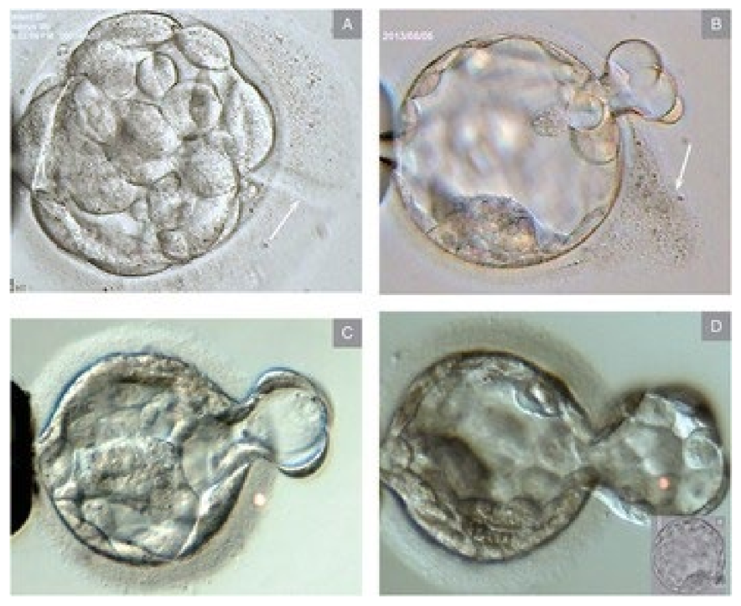 泰国LRC生殖中心(图30)